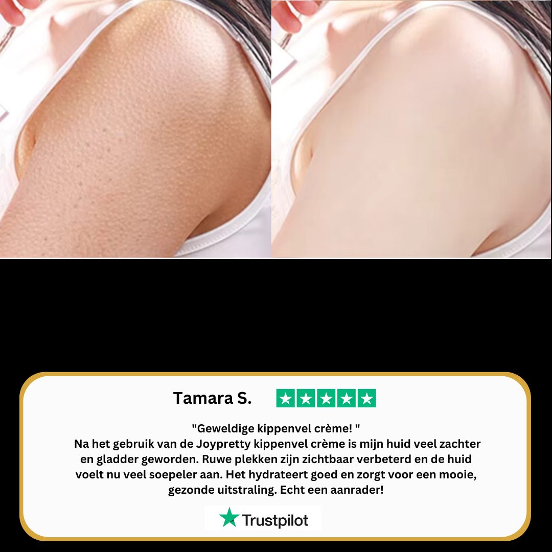 Kippenvel crème