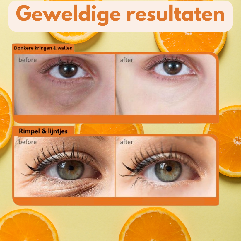 Vitamine c oogserum