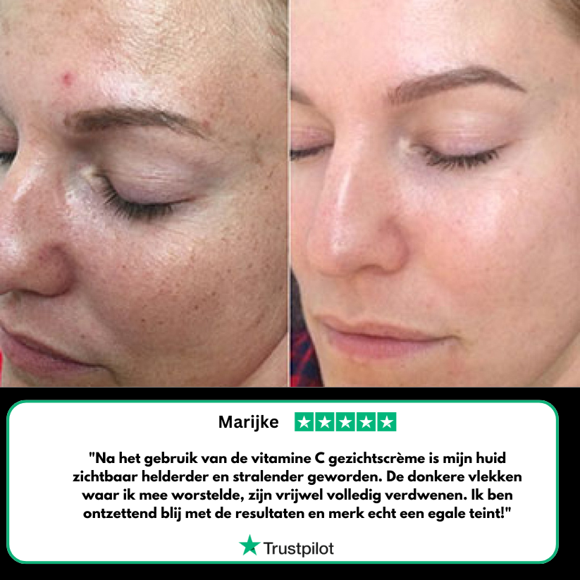 Vitamine C gezicht crème