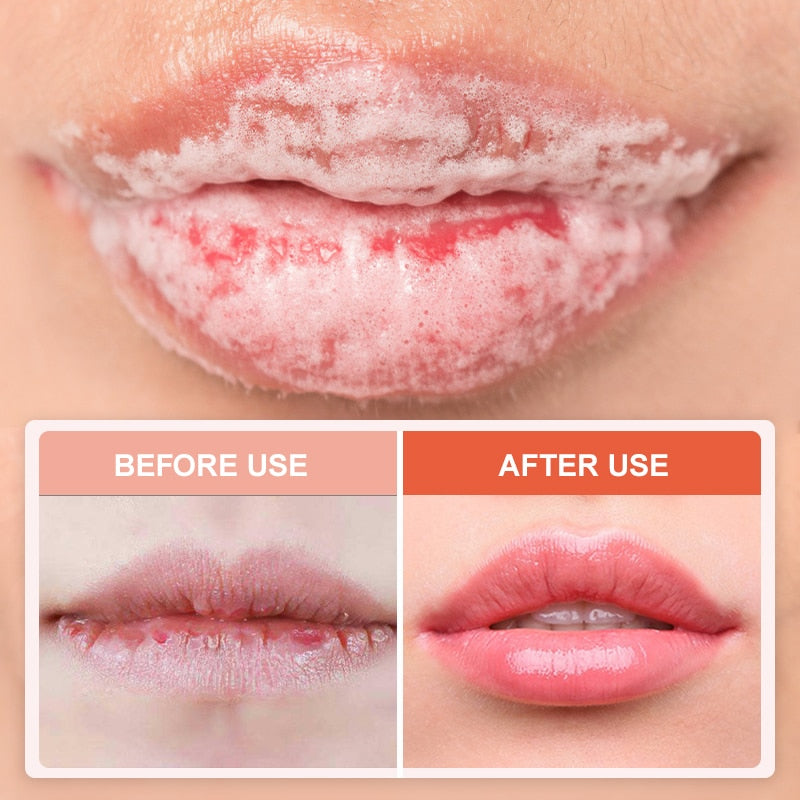 Bubbel lippen masker